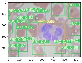 Blood Cell Classification