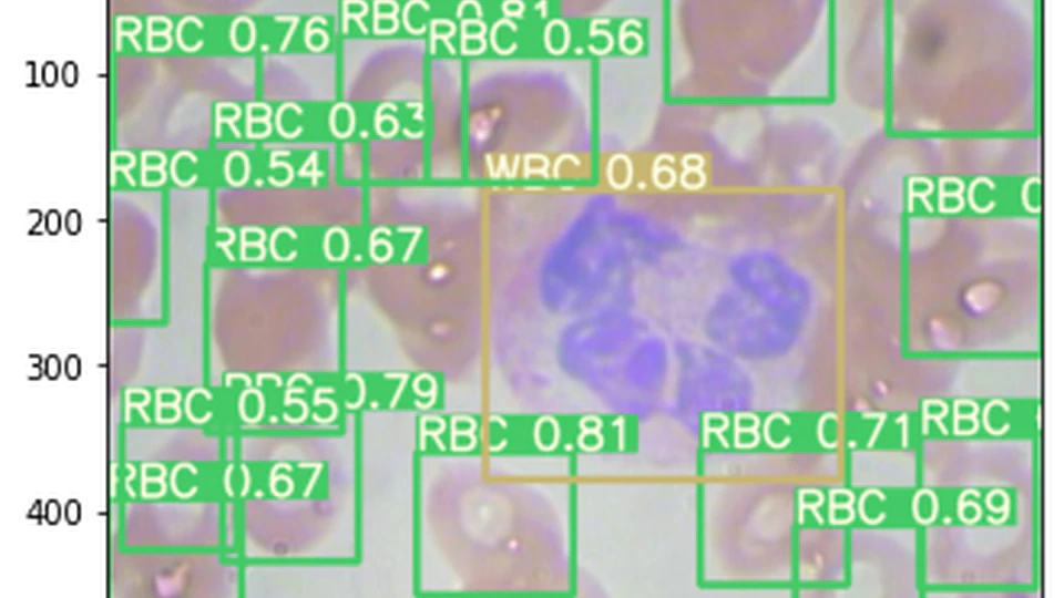 Blood Cell Classification