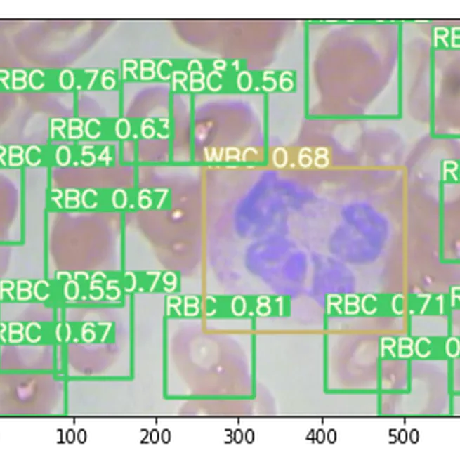 Blood Cell Classification